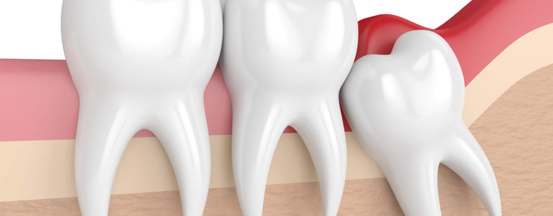 Na verdade este dente carrega em si uma decodificação importante que é o desenvolvimento da personalidade, do jeito próprio, conforme as próprias emoções, viver a vida própria. Desenvolver personalidade é ver com os próprios olhos, andar com as próprias pernas, fazer as próprias escolhas e saber que fomos nós que escolhemos assumindo a responsabilidade por essas escolhas. Para isso o eixo do indivíduo tem de estar em si.