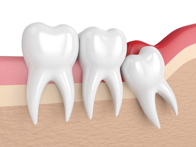 Na verdade este dente carrega em si uma decodificação importante que é o desenvolvimento da personalidade, do jeito próprio, conforme as próprias emoções, viver a vida própria. Desenvolver personalidade é ver com os próprios olhos, andar com as próprias pernas, fazer as próprias escolhas e saber que fomos nós que escolhemos assumindo a responsabilidade por essas escolhas. Para isso o eixo do indivíduo tem de estar em si.